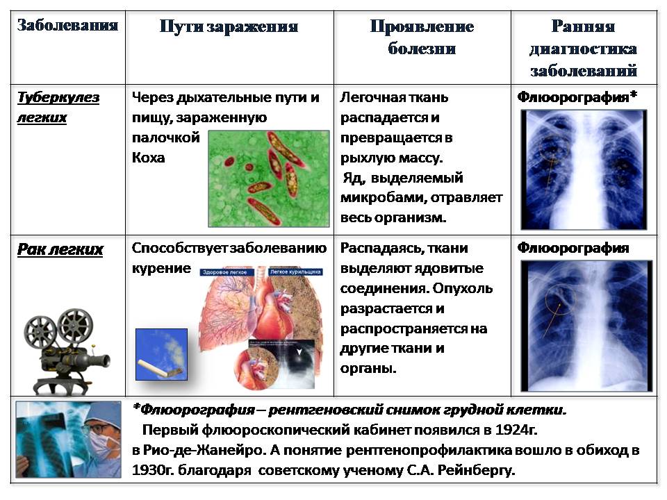 Туберкулез причины возникновения. Заболевания органов дыхательной системы. Заболевания органов дыхания таблица. Заболевание дыхательной системы туберкулез. Причины заболевания органов дыхания.